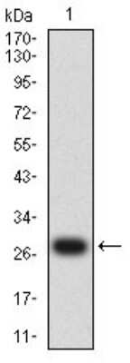 Western Blot: Dynamin 2 Antibody (3F5F3)BSA Free [NBP2-61757]