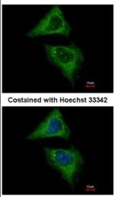 Immunocytochemistry/ Immunofluorescence: Dynamin 2 Antibody [NBP2-16244]