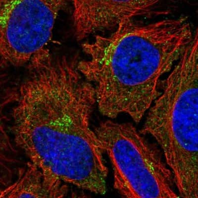 Immunocytochemistry/ Immunofluorescence: Dynamin 2 Antibody [NBP2-47477]