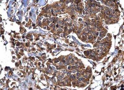 Immunohistochemistry-Paraffin: Dynamin 2 Antibody [NBP2-16244]
