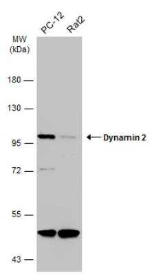 Western Blot: Dynamin 2 Antibody [NBP2-16244]