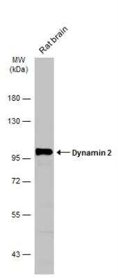 Western Blot: Dynamin 2 Antibody [NBP2-16244]