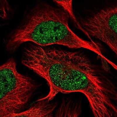 Immunocytochemistry/ Immunofluorescence: Dynamin Antibody [NBP2-48950]