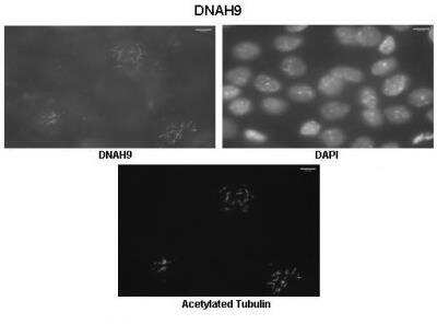 Immunohistochemistry: Dynein heavy chain Antibody [NBP2-82938]