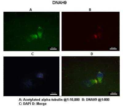 Immunohistochemistry: Dynein heavy chain Antibody [NBP2-82938]