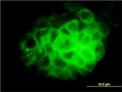 Immunocytochemistry/ Immunofluorescence: Dynein intermediate chain 2 Antibody (1C8) [H00064446-M01]