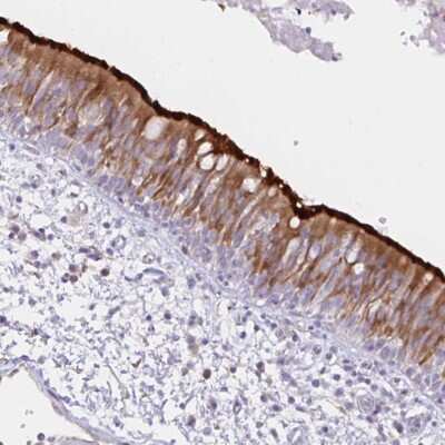 Immunohistochemistry-Paraffin: Dynein intermediate chain 2 Antibody [NBP2-37927]