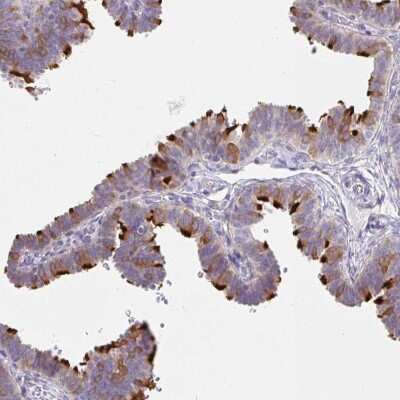Immunohistochemistry-Paraffin: Dynein intermediate chain 2 Antibody [NBP2-37927]