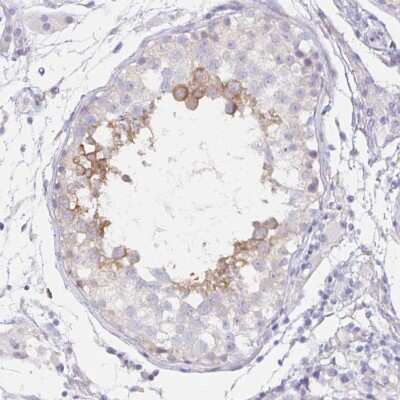 Immunohistochemistry-Paraffin: Dynein intermediate chain 2 Antibody [NBP2-37927]