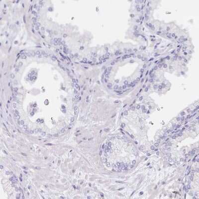 Immunohistochemistry-Paraffin: Dynein intermediate chain 2 Antibody [NBP2-37927]