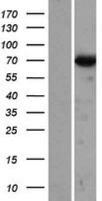 Western Blot: Dynein intermediate chain 2 Overexpression Lysate [NBP2-06383]
