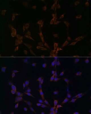 Immunocytochemistry/ Immunofluorescence: Dynein light chain 2 cytoplasmic Antibody - Azide and BSA Free [NBP2-92136]