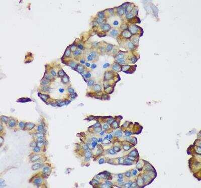 Immunohistochemistry-Paraffin: Dynein light chain 2a cytoplasmic Antibody - Azide and BSA Free [NBP2-92214]