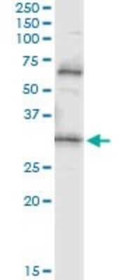 Immunoprecipitation: Prodynorphin/PDYN Antibody (2E12) [H00005173-M01]