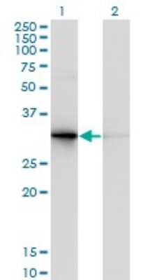 Western Blot: Prodynorphin/PDYN Antibody (2E12) [H00005173-M01]