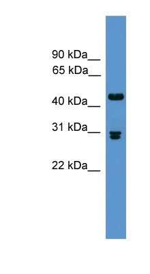 Western Blot: Prodynorphin/PDYN Antibody [NBP1-91500]
