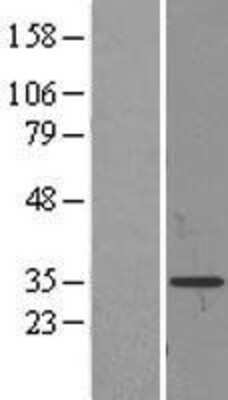 Western Blot: Prodynorphin/PDYN Overexpression Lysate [NBL1-14268]