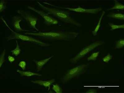 Immunocytochemistry/ Immunofluorescence: Dyrk1B Antibody (2E8) [H00009149-M10]