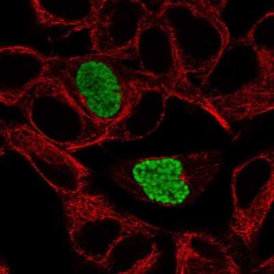 Immunocytochemistry/ Immunofluorescence: Dyrk1B Antibody [NBP2-55096]