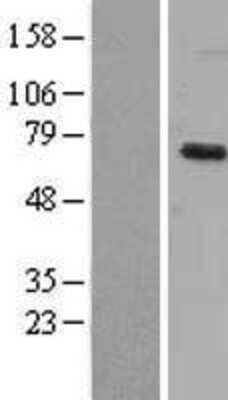 Western Blot: Dyrk1B Overexpression Lysate [NBL1-10075]