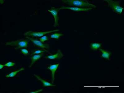 Immunocytochemistry/ Immunofluorescence: Dysbindin Antibody [H00084062-D01P]