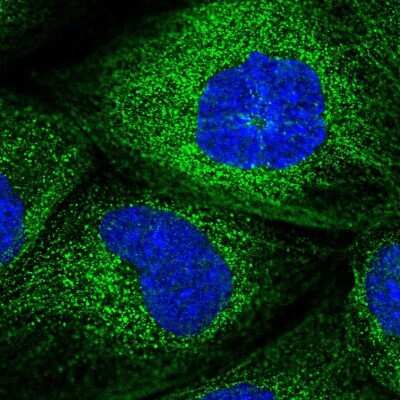 Immunocytochemistry/ Immunofluorescence: Dysbindin Antibody [NBP1-85299]