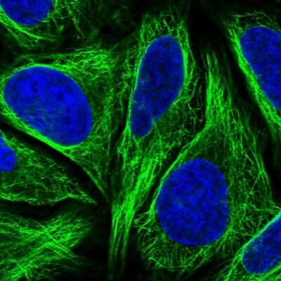 Immunocytochemistry/ Immunofluorescence: Dysbindin Antibody [NBP1-85300]