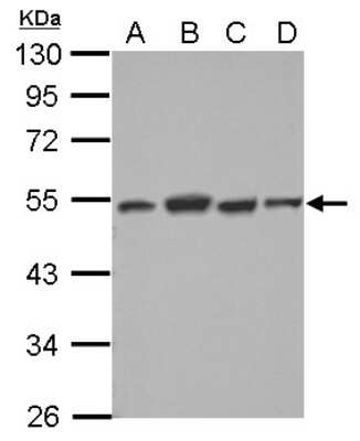 Western Blot: Dysbindin Antibody [NBP2-16245]