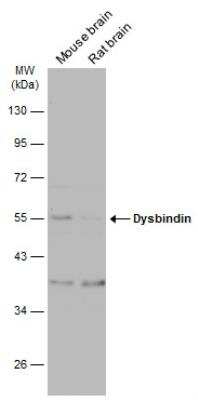 Western Blot: Dysbindin Antibody [NBP2-16245]