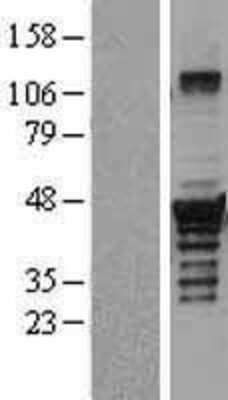 Western Blot: Dysbindin Overexpression Lysate [NBL1-10034]