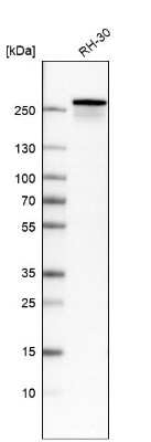 Western Blot: Dysferlin Antibody (CL10888) [NBP3-07994]