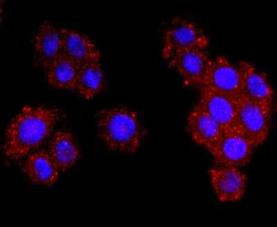 Immunocytochemistry/ Immunofluorescence: Dysferlin Antibody (JF05-54) [NBP2-66814]