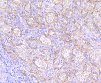 Immunohistochemistry-Paraffin: Dysferlin Antibody (JF05-54) [NBP2-66814]