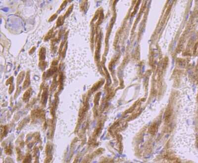 Immunohistochemistry-Paraffin: Dysferlin Antibody (JF05-54) [NBP2-66814]