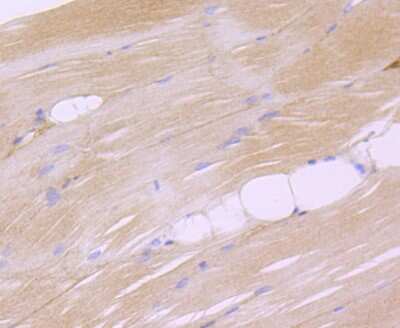 Immunohistochemistry-Paraffin: Dysferlin Antibody (JF05-54) [NBP2-66814]