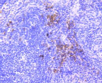 Immunohistochemistry-Paraffin: Dysferlin Antibody (JF05-54) [NBP2-66814]