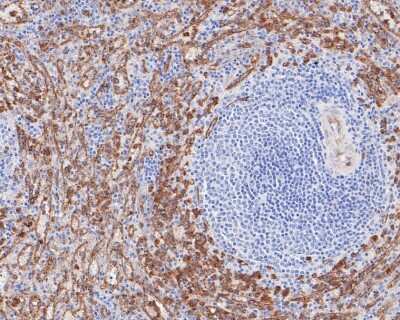 Immunohistochemistry-Paraffin: Dysferlin Antibody (JF05-54) [NBP2-66814]