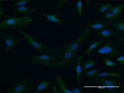 Immunocytochemistry/ Immunofluorescence: Dystrobrevin alpha Antibody [H00001837-B01P]