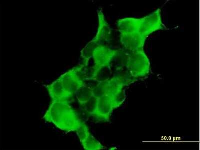 Immunocytochemistry/ Immunofluorescence: Dystrobrevin alpha Antibody [H00001837-B01P]