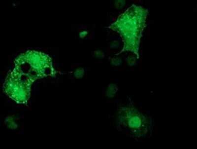 Immunocytochemistry/ Immunofluorescence: Dystrobrevin alpha Antibody (OTI1B2) - Azide and BSA Free [NBP2-70591]