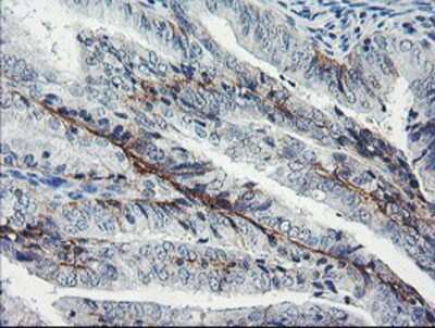 Immunohistochemistry-Paraffin: Dystrobrevin beta Antibody (OTI3A12) [NBP2-01798]