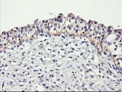Immunohistochemistry-Paraffin: Dystrobrevin beta Antibody (OTI3A12) [NBP2-01798]