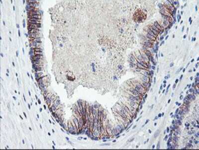 Immunohistochemistry-Paraffin: Dystrobrevin beta Antibody (OTI3A12) [NBP2-01798]