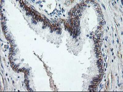Immunohistochemistry-Paraffin: Dystrobrevin beta Antibody (OTI3A12) [NBP2-01798]