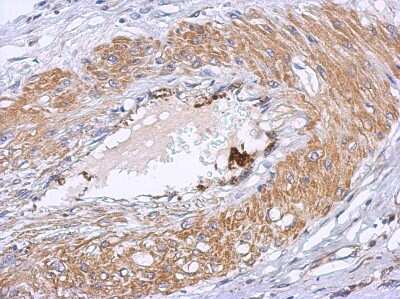 Immunohistochemistry-Paraffin: Dystrobrevin beta Antibody [NBP2-16246]