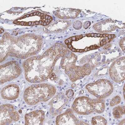 Immunohistochemistry-Paraffin: Dystrobrevin beta Antibody [NBP2-38915]