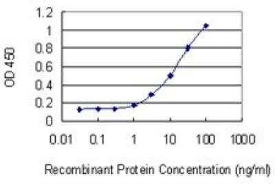 ELISA: Dystrophin Antibody (3A11) [H00001756-M07]