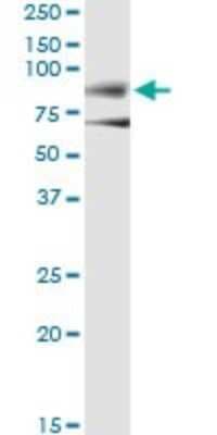 Immunoprecipitation: Dystrophin Antibody (3A11) [H00001756-M07]