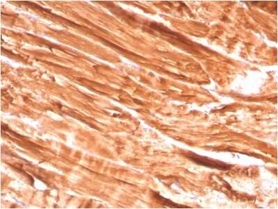 Immunohistochemistry-Paraffin: Dystrophin Antibody (DMD/3242) [NBP2-79783]
