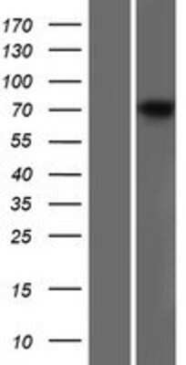 Western Blot: Dystrophin Overexpression Lysate [NBP2-10564]